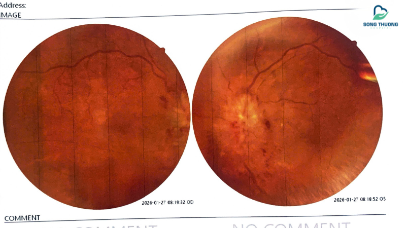 PHÙ GAI THỊ HAI MẮT – ĐỪNG CHỦ QUAN